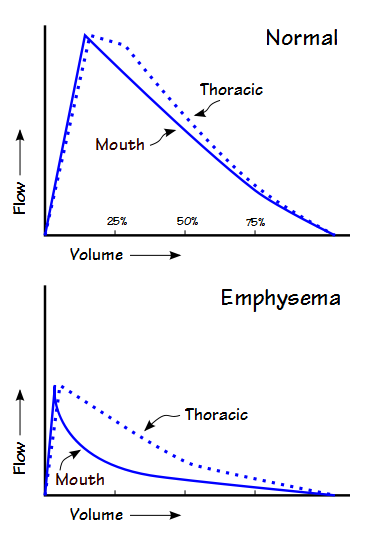 Low VO2 Normal CI