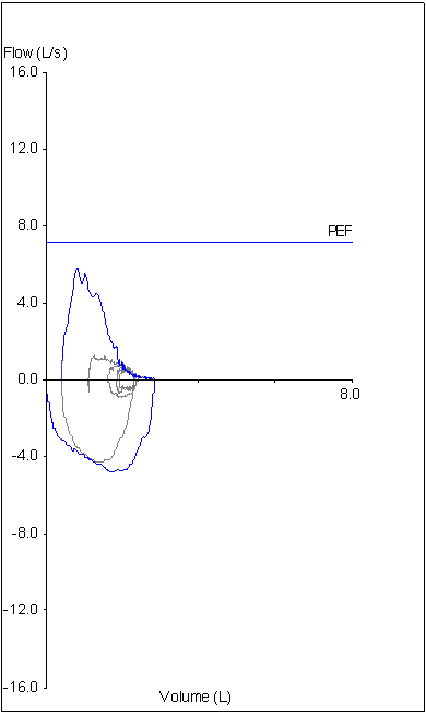 Hidden FIVC redacted 3