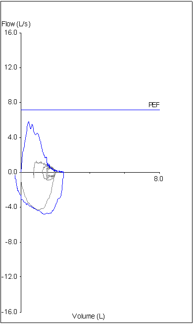 Hidden FIVC_redacted 1