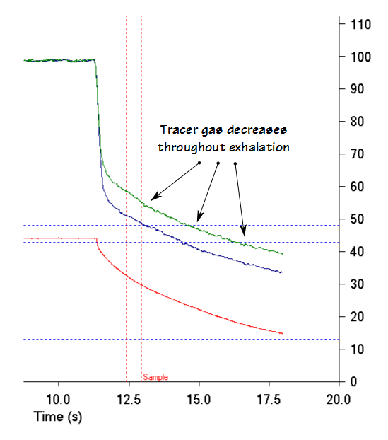 COPD_Exhaled_CH4_Declines