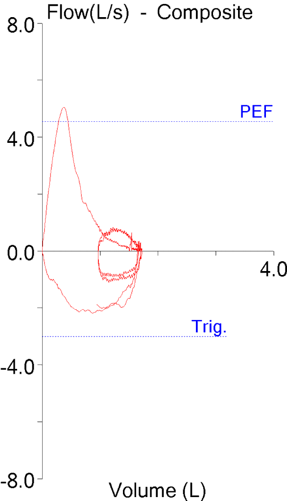 SVC_TLC_Under_FVL_redacted