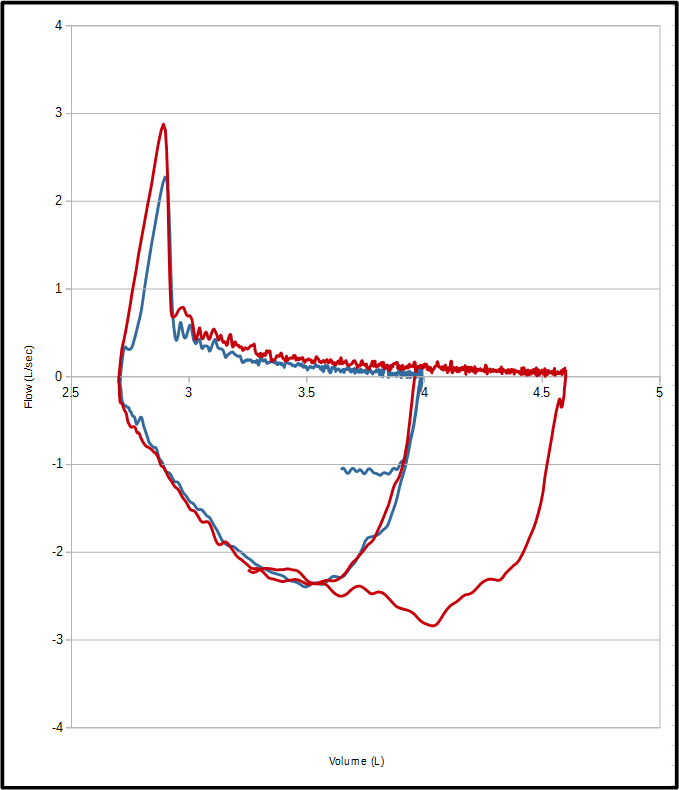 delta-fvc-fvl-overlay