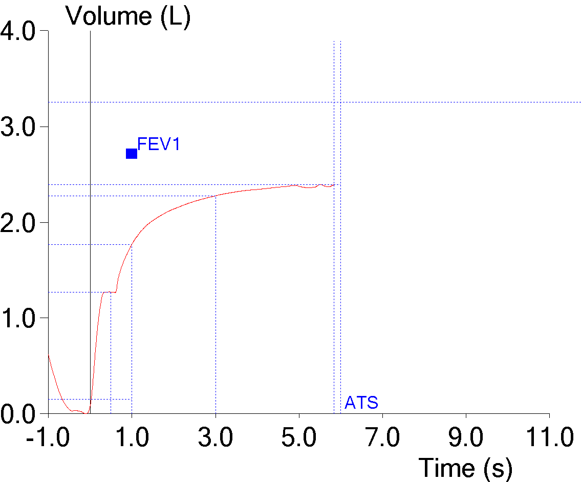expiratory_pause_fev1_underestimated_vt_2