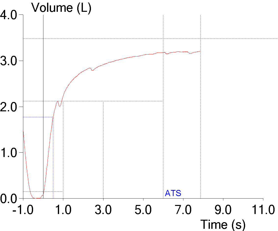 mid_expiratory_inspiration_fvc_underestimated_vt